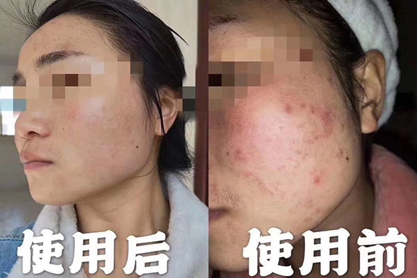 精油能喝嗎？不是所有精油都能喝-歐泉生化